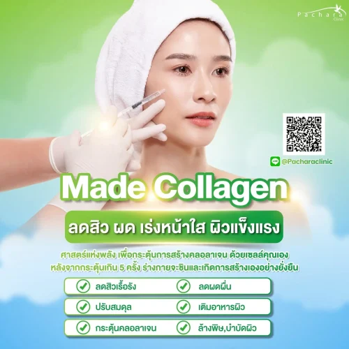 acne-treatment