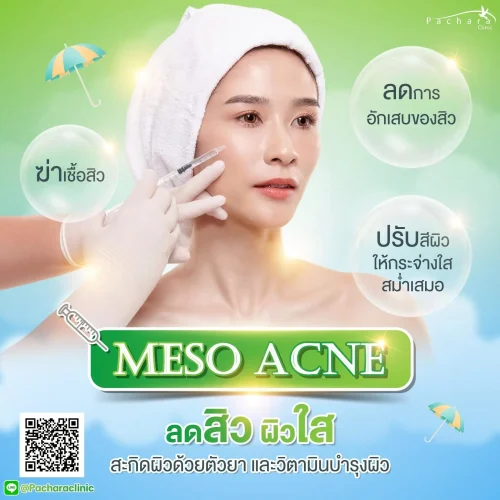 acne-treatment2