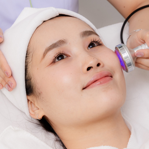 pore_minimizing (2)